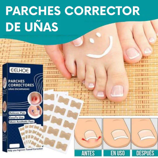 Parche corrector de uñas y hongos - IngroPatch™(Pack x50 und)